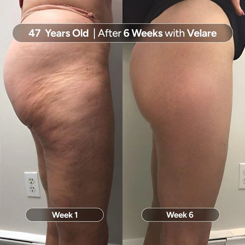 Orynel™ Collagen + Stem Cells Cellulite Oil